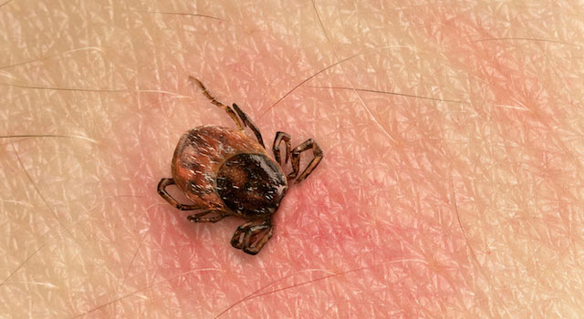 blog-signs-of-lyme-disease