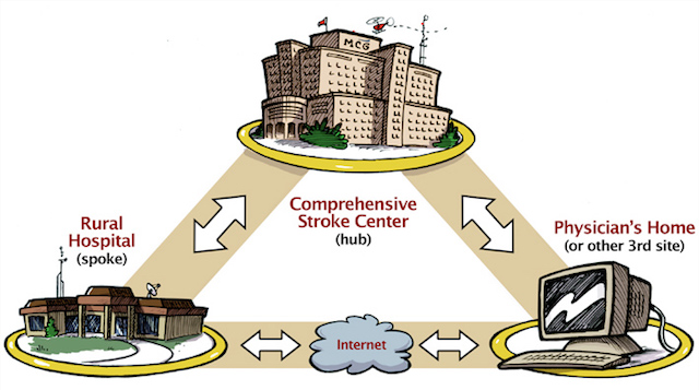 blog-hub-spoke-stroke