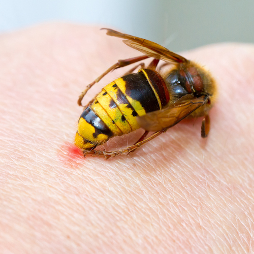 When Do Bug Bites Need Medical Attention? MeMD